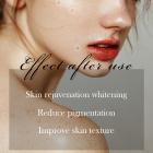 DPL+NIR Photofacial Pro – Professionelles DPL Milchlicht Gesichtsgerät, Flecken entfernen, Haut straffen & Anti-Aging zu Hause