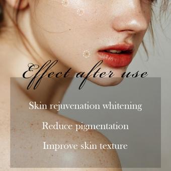 DPL+NIR Photofacial Pro – Professionelles DPL Milchlicht Gesichtsgerät, Flecken entfernen, Haut straffen & Anti-Aging zu Hause