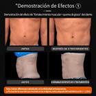 Dispositivo para modelar el cuerpo EMS NEO, con dos mangos y un diseño compacto de sobremesa para uso doméstico. 