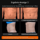 EMS NEO Körperformungsgerät – Professionelles RF & EMS Body Sculpting Gerät mit Zwei Griffen für Bauch, Taille, Arme und Beine – Muskelaufbau & Fettabbau für Zuhause und Studio