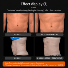 EMS NEO Körperformungsgerät – Professionelles RF & EMS Body Sculpting Gerät mit Zwei Griffen für Bauch, Taille, Arme und Beine – Muskelaufbau & Fettabbau für Zuhause und Studio