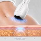 UC - BodySlim 3.0 Niet-Invasief Ultrasoon Vetreductieapparaat – voor Buik, Dijen, Armen en Heupen