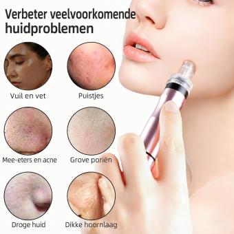 HOBA - FacialClean 1.0 Plus Diep Reinigend Vacuüm Mee-eterverwijderingsapparaat – Hydro Jet met Waterspray, 8 Opzetstukken, Zuurstof en Kleine Bubbels voor Gezichtsverzorging