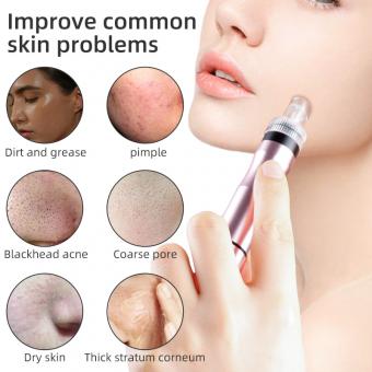 FREYARA HOBA - FacialClean 1.0 Plus, Tiefenreinigungsgerät für Poren mit Vakuumtechnologie, Mit Wassersprühfunktion und Hydrojet, 8-in-1 Sauerstoff-Skin-Care System FREYARA HOBA - FacialClean 1.0 Plus, Tiefenreinigungsgerät für Poren mit Vakuumtechnologie, Mit Wassersprühfunktion und Hydrojet, 8-in-1 Sauerstoff-Skin-Care System