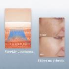 FREYARA 3-in-1 Anti-Aging Nano-Spray Gezichtsapparaat met MIFR-Microstroom en Blauw LED-Licht – voor Diepe Infusie, Gezichtslifting, Acne, Kaaklijncontouring, Hydratatie en Verzachting