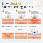FREYARA Professional Face and Body Gold RF Microneedling Device with Ice Hammer for Shrink Pores, Fill Acne Scars, Lift Sagging Skin, Erase Wrinkles, Stop Oily Skin and Reduce Blackheads