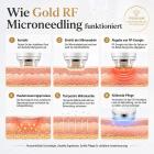 Professionelles Gold RF Microneedling Gerät für Gesicht & Körper mit Ice Hammer zur Porenverfeinerung, Reduzierung von Aknenarben, Hautstraffung, Faltenreduktion, Regulierung fettiger Haut und Minimierung von Mitessern