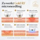 FREYARA Professioneel Gouden RF-Microneedlingapparaat voor Gezicht en Lichaam met Ice Hammer – voor Poriënverkleining, Opvullen van Acnelittekens, Lifting van Verslapte Huid, Rimpelverwijdering, Vermindering van Vette Huid en Mee-eters