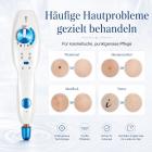 PM FacialPure 1.0 Premier Plasma Pen – Multifunktionale Hautpflegetechnologie für ein klareres, strafferes und gesünderes Hautbild
