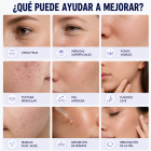 FacialPure Premier Plasma Pen™ - Reafirma, Renueva y Revitaliza Tu Piel Desde Casa, Dispositivo de Rejuvenecimiento Facial 4 en 1