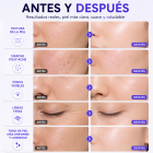 FacialPure 2.0 - Bolígrafo De Plasma De Ozono Multifunción: Elimina Lunares Y Manchas, Promueve La Absorción Del Suero Y Limpia La Piel.