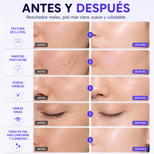 FacialPure 2.0 - Bolígrafo De Plasma De Ozono Multifunción: Elimina Lunares Y Manchas, Promueve La Absorción Del Suero Y Limpia La Piel.