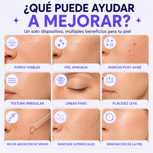 FacialPure 2.0 - Bolígrafo De Plasma De Ozono Multifunción: Elimina Lunares Y Manchas, Promueve La Absorción Del Suero Y Limpia La Piel.