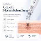 LASER FacialPure Lite – Der Blaulicht-Pikosekunden-Laserstift gegen Pigmentflecken, Hauterneuerung & Melaninentfernung