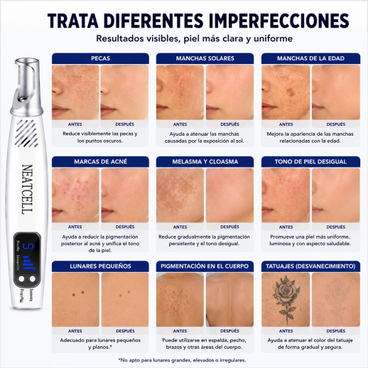 FacialPure Lite™ – Lápiz Láser de Luz Azul para Manchas y Pigmentación, el láser de picosegundos de luz azul para manchas, renovación cutánea y eliminación de melanina.