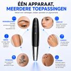 FREYARA FacialPure LS008 Picoseconde Laserpen voor Thuisgebruik met Blauwlichtpositionering – voor het Verwijderen van Sproeten, Pigmentvlekken, Tatoeages en Wenkbrauwtatoeages