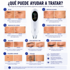 LASER FacialPure Pro, lápiz láser de picosegundos inalámbrico para uso doméstico con posicionamiento mediante luz azul, adecuado para atenuar tatuajes y manchas oscuras.