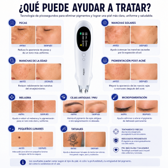 LASER FacialPure Pro, lápiz láser de picosegundos inalámbrico para uso doméstico con posicionamiento mediante luz azul, adecuado para atenuar tatuajes y manchas oscuras.