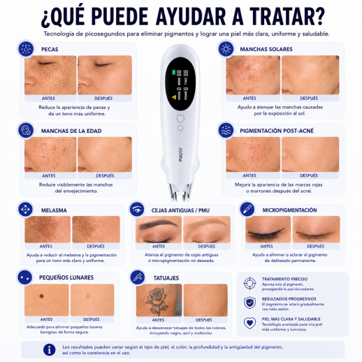 LASER FacialPure Pro, lápiz láser de picosegundos inalámbrico para uso doméstico con posicionamiento mediante luz azul, adecuado para atenuar tatuajes y manchas oscuras.