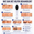 LASER FacialPure Pro Draadloze Picoseconde Laserpen voor Thuisgebruik met Blauwlichtpositionering – voor het Vervagen van Tatoeages en Donkere Vlekken