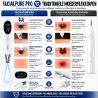 LASER FacialPure Pro Draadloze Picoseconde Laserpen voor Thuisgebruik met Blauwlichtpositionering – voor het Vervagen van Tatoeages en Donkere Vlekken