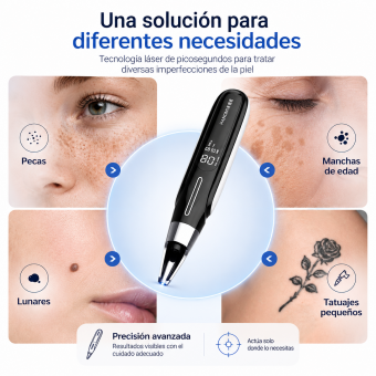 Láser FacialPure LS006, lápiz láser de picosegundos inalámbrico para uso doméstico, adecuado para eliminar pecas, borrar tatuajes, manchas oscuras y atenuar la pigmentación.