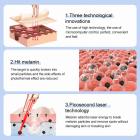 FREYARA LASER FacialPure Lite Upgrade, Professional Blue Light Picosecond Laser Pen for Tattoo and Mole Removal