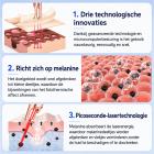 FREYARA LASER FacialPure Lite Upgrade – Professionele Picoseconde Laserpen met Blauw Licht voor Tatoeages en Moedervlekken