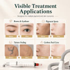 LASER FacialPure 4.0, Portable Small Trolley Case Non-invasive Laser Picosecond Machine, Tattoo Remover and Eyebrow Removal