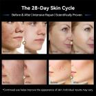 Dr. Pen M9 Professioneller Microneedling Dermapen, Smart Auto-Adjust, mit 10 Nadeln Patronen, 18pin