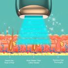 Dispositivo de depilación láser IPL para mujeres cuerpo facial permanente, refrigeración por hielo sin dolor, velocidad de flash de 0,5 s, carga de enchufe