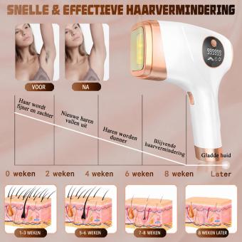 IPL-Laserontharingsapparaat voor Permanente Ontharing Thuis – Pijnloze IJskoeling voor het Hele Lichaam, 999.999 Flitsen, 5 Intensiteitsniveaus, FDA-Gecertificeerd, met Netvoeding