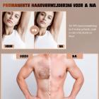 IPL-Laserontharingsapparaat voor Permanente Ontharing Thuis – Pijnloze IJskoeling voor het Hele Lichaam, 999.999 Flitsen, 5 Intensiteitsniveaus, FDA-Gecertificeerd, met Netvoeding