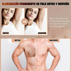 Depilación láser IPL permanente en casa, enfriamiento con hielo indoloro para todo el cuerpo, 999999 destellos, 5 niveles, certificado por la FDA, carga rápida.