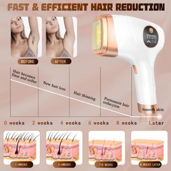 Dauerhafte IPL Laser Haarentfernung zu Hause, Eisschmerzlos, 999999 Blitze, 5 Stufen, FDA Zertifiziert, Steckerladung