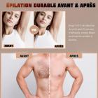Épilateur Lumière Pulsée, IPL Épilation Laser avec FDA Certifié, 5 Niveaux, 999999 Flashs, Glace Indolore, pour Visage, Corps, Bikini, Aisselles