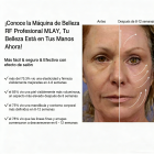 Dispositivo de belleza por radiofrecuencia de grado profesional MLAY, adecuado para levantar, reafirmar, reducir las arrugas y tensar la piel del rostro y el cuerpo. Entrega estimada en un plazo de 4 a 7 días laborables.