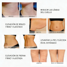 Dispositivo de belleza por radiofrecuencia de grado profesional MLAY, adecuado para levantar, reafirmar, reducir las arrugas y tensar la piel del rostro y el cuerpo. Entrega estimada en un plazo de 4 a 7 días laborables.