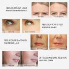 MLAY Professional RF Beauty Machine for Lifting, Toning, Wrinkle Removal, Facial and Body Skin Tightening, Plug Charge