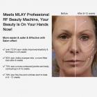 MLAY Professional RF Beauty Machine for Lifting, Toning, Wrinkle Removal, Facial and Body Skin Tightening, Plug Charge