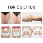 Mini 40K ultralyd kavitationsmaskine til fedtreduktion og kropsformning – reducerer cellulite og opstrammer huden