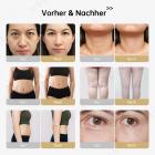 4in1 40K Abnehmen Maschine Vakuum Radiofrequenz Ultraschall Kavitationsgerät, Fettverbrennung, Anti Cellulite Schönheitsmaschine zur Körperformung mit Gesicht, Arm, Taille, Bauch, Bein