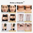 Máquina de cavitación ultrasónica por radiofrecuencia 4 en 1 de 40K, dispositivo para esculpir rostro, brazos, cintura, abdomen y piernas.