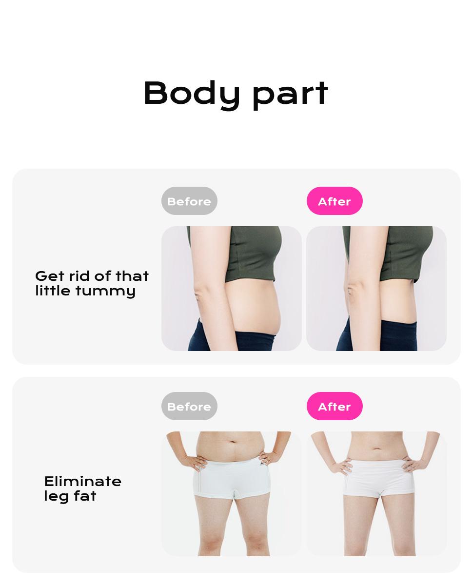 Supplied before-and-after artwork with belly and thigh comparisons