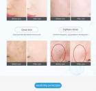 Face Skin Cooling Device, Cryotherapy Electroporation Needle-Free Mesotherapy Skin Rejuvenation Machine