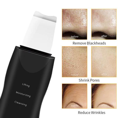 Professional using Ultrasonic Skin Scrubber EMS 28K in spa setting