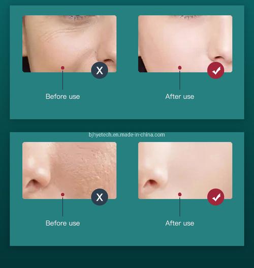 red light therapy for hair growth