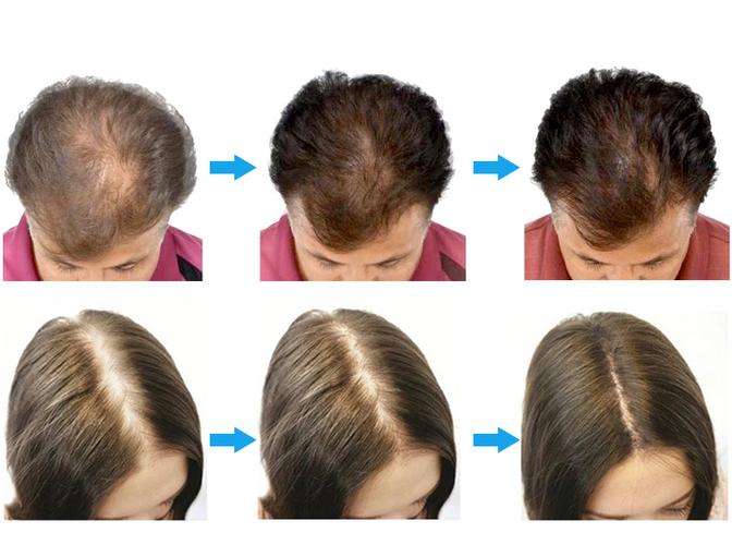 Red light therapy device assembly line with quality control checkpoints