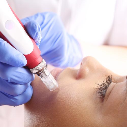 Microneedling manufacturing process with ISO 13485 certification