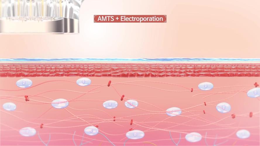dermapen microneedling